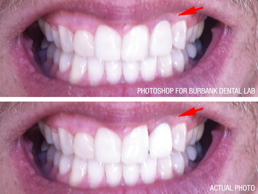 Photoshop Photos for Burbank Dental Lab | Go Dental